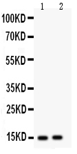 1 - Anti-Fatty Acid Binding Protein 5 Antibody ABO10794