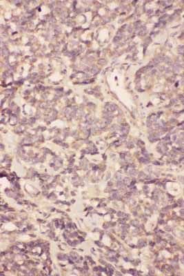 2 - Anti-FGF19 Antibody ABO10795