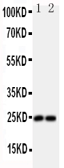 1 - Anti-FGF19 Antibody ABO10795