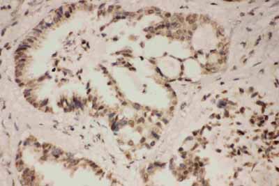 2 - Anti-FGFR1 Antibody ABO10796