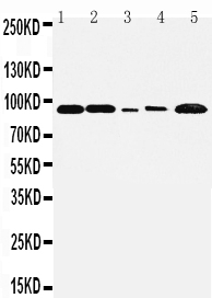 1 - Anti-FGFR1 Antibody ABO10796