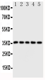1 - Anti-Fos B Antibody ABO10797