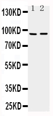 1 - Anti-ADAMTS4 Antibody ABO10798