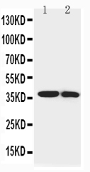 1 - Anti-IGFBP-1 Antibody ABO10799