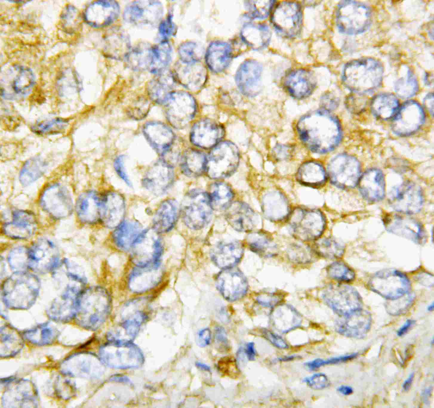 2 - Anti-AIMP2/p38 Antibody ABO10800