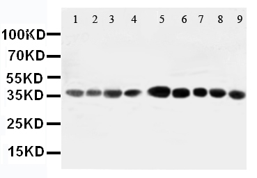 1 - Anti-AIMP2/p38 Antibody ABO10800