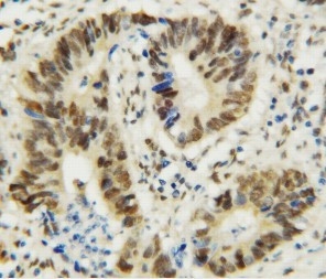 2 - Anti-MTA1 Antibody ABO10802