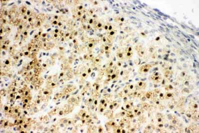 2 - Anti-MTA1 Antibody ABO10802