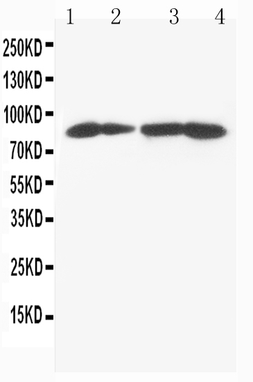 1 - Anti-MTA1 Antibody ABO10802