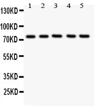 1 - Anti-12 Lipoxygenase Antibody ABO10804