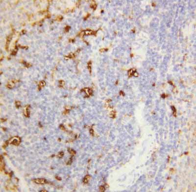 2 - Anti-Alpha Amylase 1 Antibody ABO10805