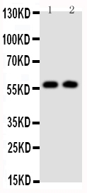 1 - Anti-Alpha Amylase 1 Antibody ABO10805