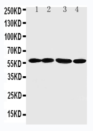 1 - Anti-ANGPTL1 Antibody ABO10806