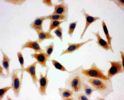 8 - Anti-Aquaporin 3 Antibody ABO10807