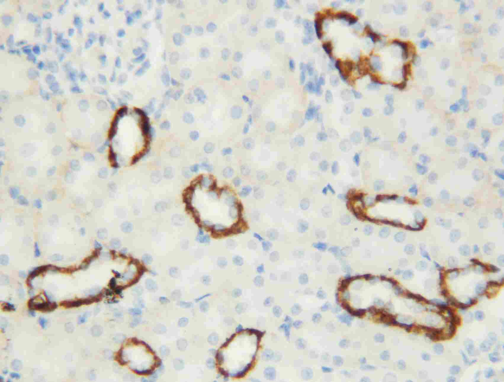 2 - Anti-Aquaporin 3 Antibody ABO10807