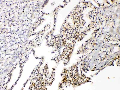 2 - Anti-Aquaporin 3 Antibody ABO10807