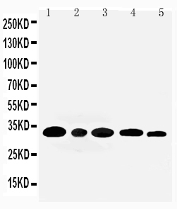 1 - Anti-Aquaporin 3 Antibody ABO10807