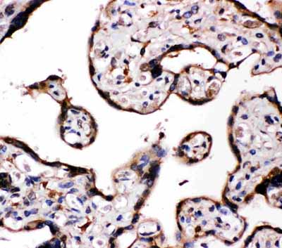 2 - Anti-Aromatase Antibody ABO10808