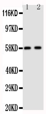 1 - Anti-Aromatase Antibody ABO10808
