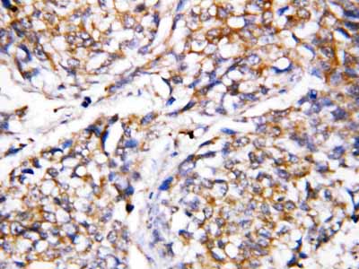 2 - Anti-Caspase 4 Antibody ABO10809
