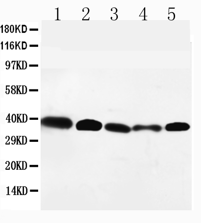 1 - Anti-GPR2/CCR10 Antibody ABO10810