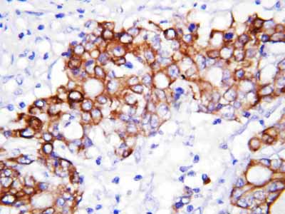 2 - Anti-GCLC Antibody ABO10811
