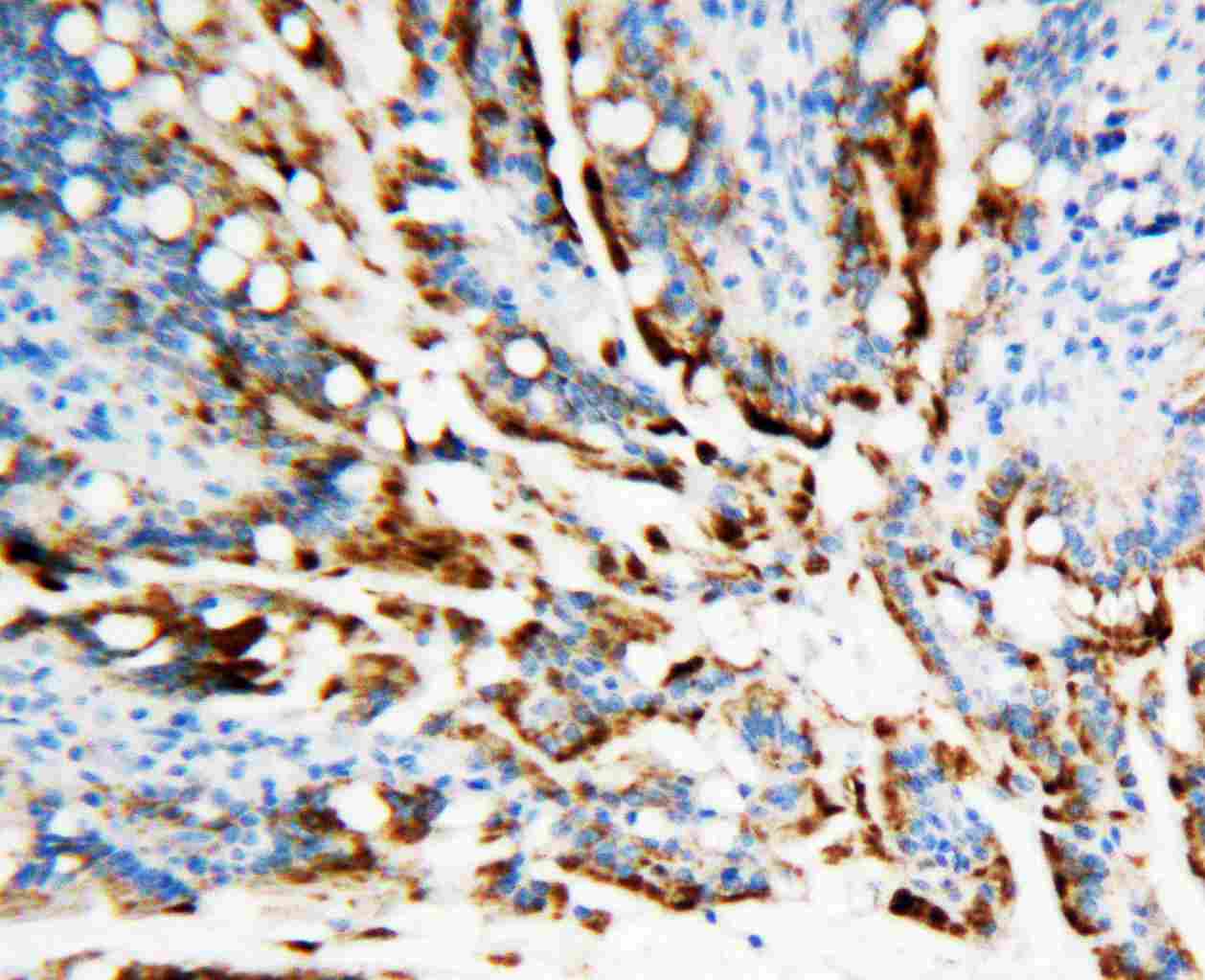 2 - Anti-APE1 Antibody ABO10813