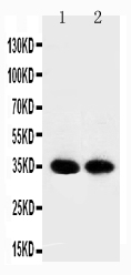 1 - Anti-APE1 Antibody ABO10813