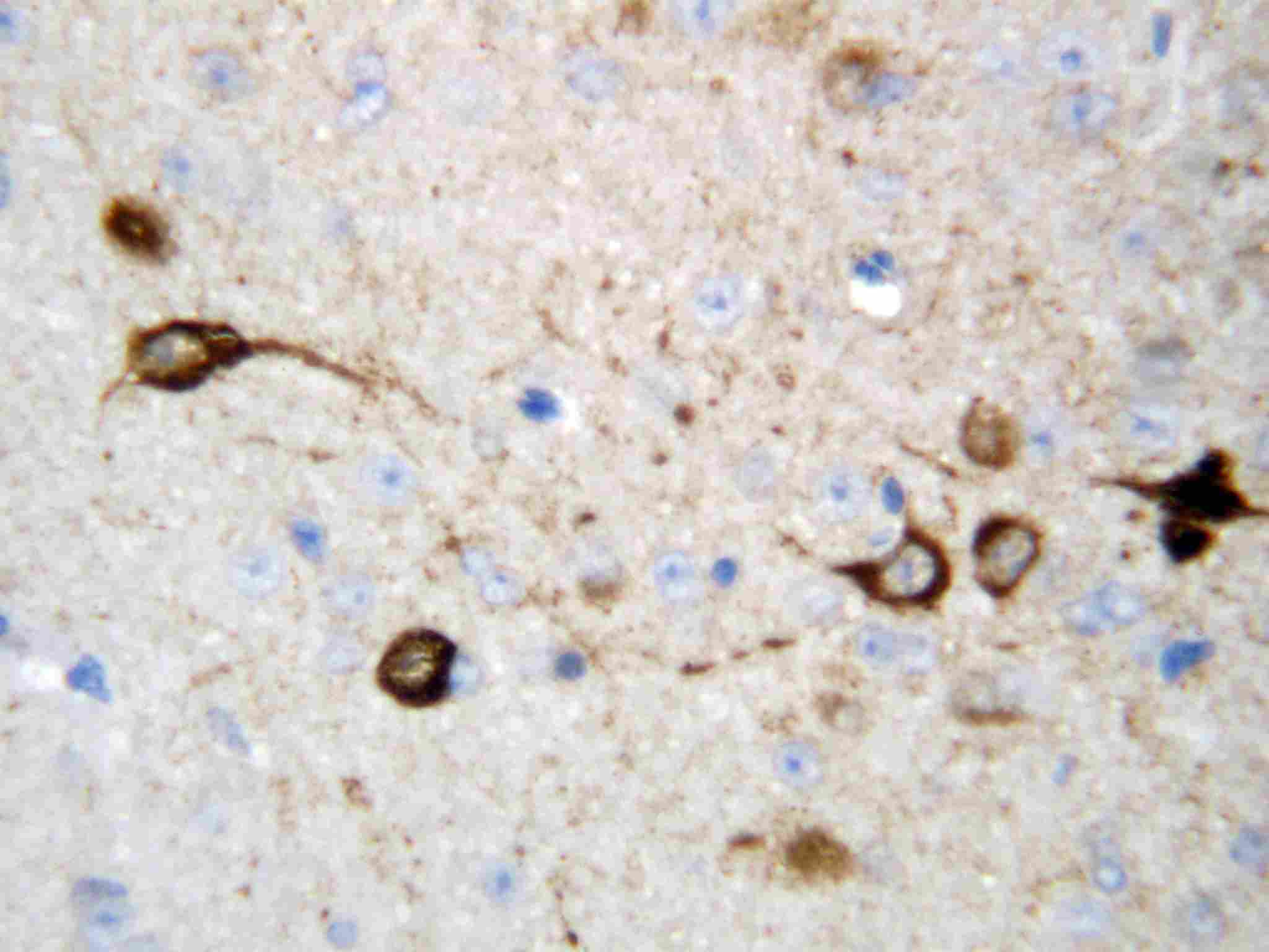2 - Anti-CAMKK2 Antibody ABO10816