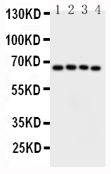 1 - Anti-CAMKK2 Antibody ABO10816