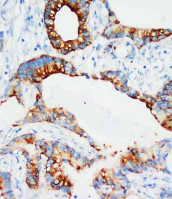 2 - Anti-IGFBP-3 Antibody ABO10817