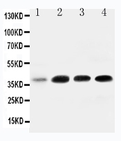 1 - Anti-IGFBP-3 Antibody ABO10817
