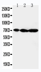 1 - Anti-MEKK2 Antibody ABO10818