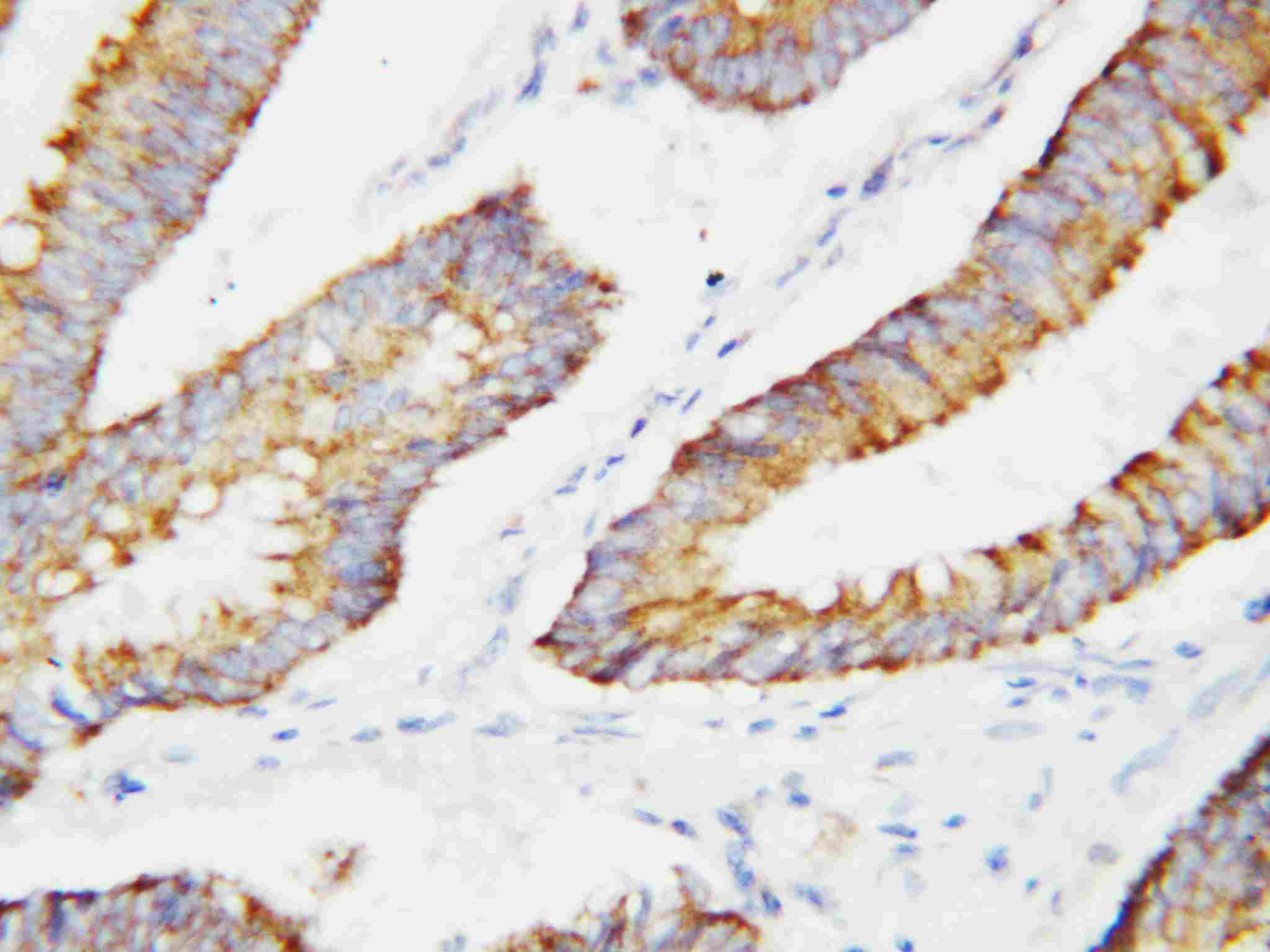 2 - Anti-BCAT2 Antibody ABO10820