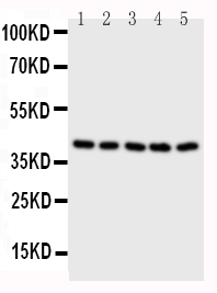 1 - Anti-BCAT2 Antibody ABO10820