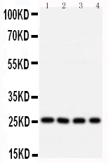 1 - Anti-Bcl10 Antibody ABO10822