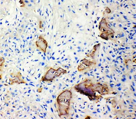 2 - Anti-Bone SialoProtein Antibody ABO10823