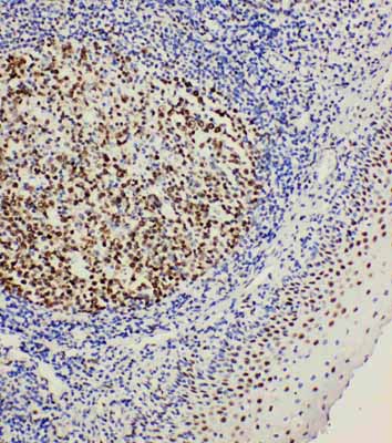 2 - Anti-BOB1 Antibody ABO10824