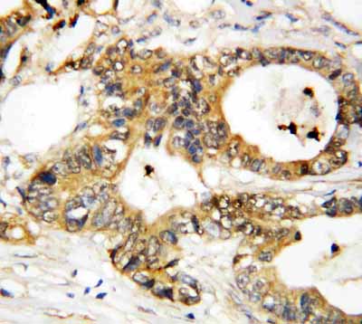 2 - Anti-Annexin A3 Antibody ABO10828