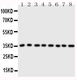 1 - Anti-Annexin A3 Antibody ABO10828