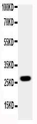 1 - Anti-Aquaporin 8 Antibody ABO10829