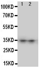 1 - Anti-Aquaporin 8 Antibody ABO10829
