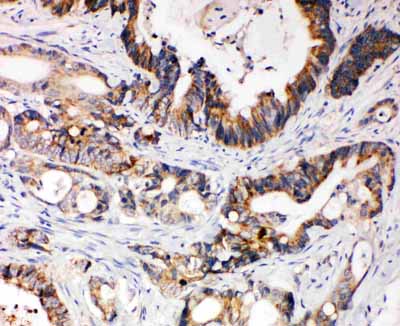 2 - Anti-XIAP Antibody ABO10830