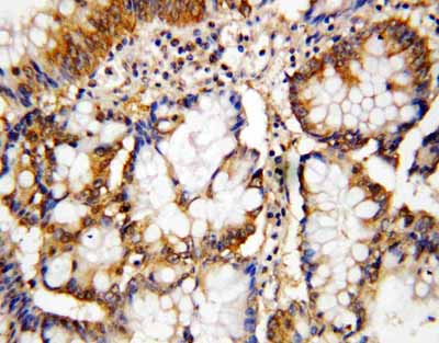2 - Anti-Caspase-10 Antibody ABO10831