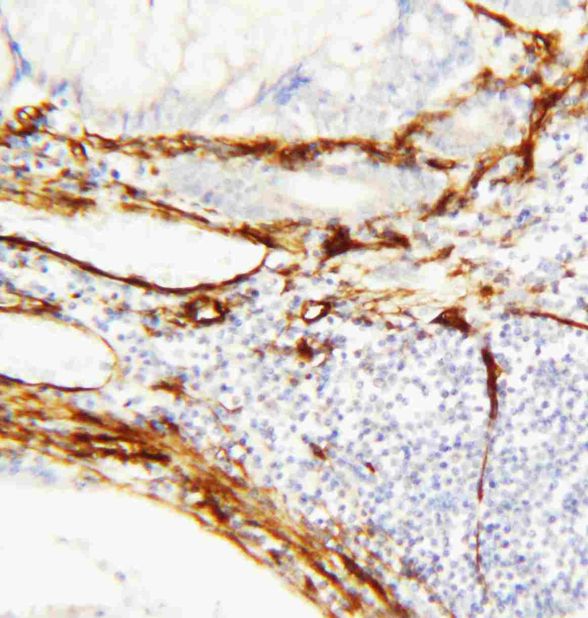 2 - Anti-Caveolin-1 Antibody ABO10832