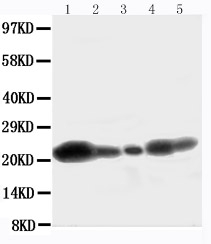 1 - Anti-Caveolin-1 Antibody ABO10832