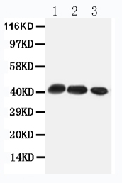 1 - Anti-CCR4 Antibody ABO10835