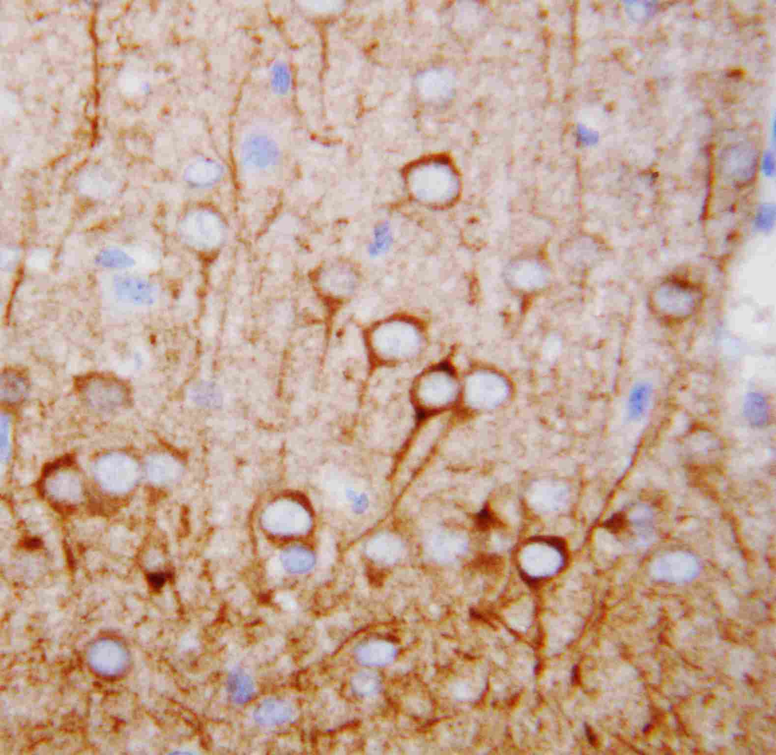2 - Anti-CaMKK Antibody ABO10839