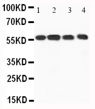 1 - Anti-CaMKK Antibody ABO10839