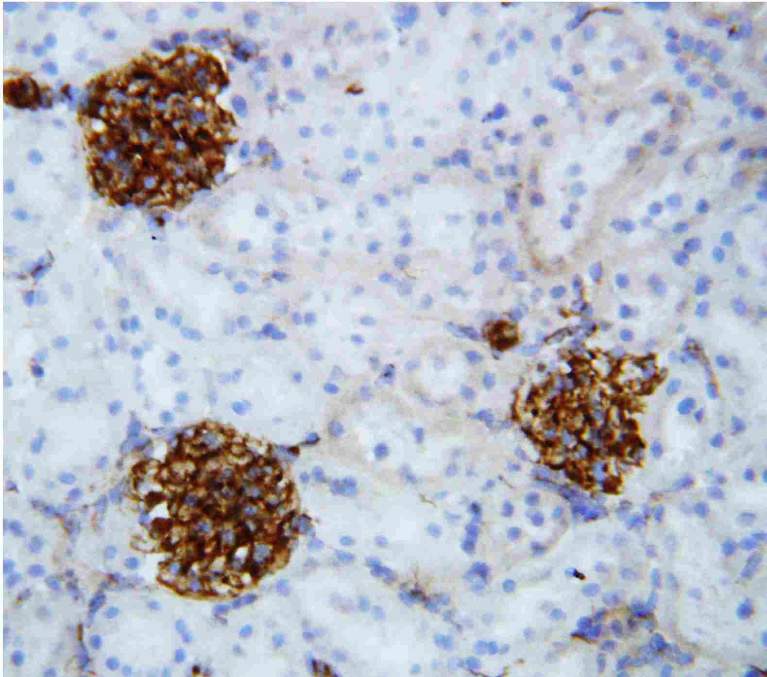 2 - Anti-Collagen IV Antibody ABO10840
